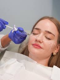 Nicole Borrelli, RN Aesthetic Nurse Injector is now taking clients at our  Wellesley location! Nicole is an aesthetic nurse injector of neurotoxins  and facial fillers. She is also a Master Aethetician. She