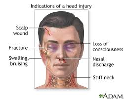 Driving a motor vehicle is dangerous business. Head Injury First Aid Medlineplus Medical Encyclopedia