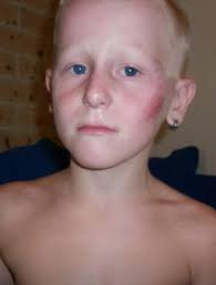 Sydney mum forgives truck driver after son crashed into it