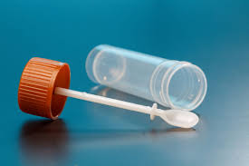 Savoir si on a des vers. Examen Parasitologique Des Selles Comment Faire