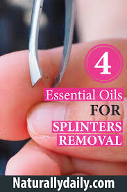 4 Essential Oils For Splinters Removal Splinter Removal Essential Oils Essential Oils For Kids