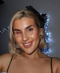 The Traitors star Livi Deane reveals her rare eye cancer was only picked up  after begging her mum to take her to the opticians because she was jealous  of her sister's glasses -