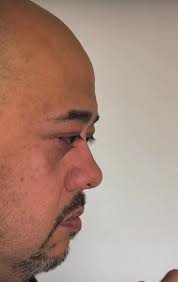 Eyes that pop out of their head… Steve.