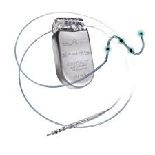 Image result for Internal Cardiac Defibrillator