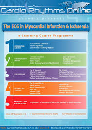 Pin By Jason Winter Ecg Educator On Ekg Memo Cards Coronary Circulation Acute Coronary Syndrome Learning Courses