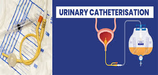 Image result for Urethral Catheterization