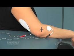 electrode placement for supination option 1