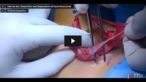 Image result for Inguinal hernia child