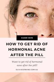 Birth Control Pills That Help With Acne Pin On Clear Skin