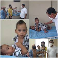 Baiklah berikut ini adalah cara membuat anak metode ini dianggap paling praktis dan gampang untuk mendapatkan anak kembar. Ke 4 Kali Rsup Ham Siap Pisahkan Bayi Kembar Siam Rsup H Adam Malik
