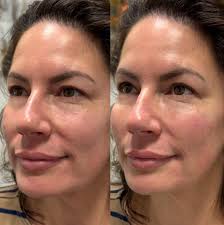 REFINED AESTHETICS (@refined.aesthetics) · Instagram 照片和视频