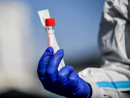Wird das material nicht korrekt entnommen, riskiert man ein negatives ergebnis, obwohl eine infektion vorliegt. Experts Worry People Who Should Test Positive For Coronavirus Are Not