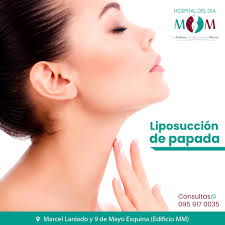 Milton Marquez Master en Cirugia Estética