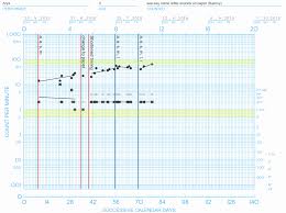 Behavior analysts use this tool to display behavioral data, document environmental changes, and analyze progress toward meaningful outcomes. Using Precision Teaching To Take The Guesswork Out Of Analysis Centralreach