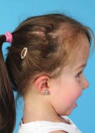 The management and diagnosis of syndromic craniofacial cases