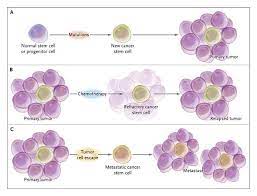 Cancer Stem Cells Nejm