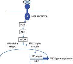 Advanced lung cancer symptoms in advanced stages of lung cancer, the cancer usually metastasizes to both lungs and other organs, such as the bones or brain. Crizotinib Improves Osteoarthritis Symptoms In A Ros1 Fusion Advanced Non Small Cell Lung Cancer Patient Journal Of Thoracic Oncology