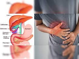 Learn tamilhuman body parts in tamil add missing human body parts. Gallbladder Stones Gallstones à®ª à®¤ à®¤à®ª à®ª à®¯ à®² à®•à®² à®‡à®° à®• à®• à®¨ à®™ à®•à®³ à®•à®£ à®Ÿ à®ª à®Ÿ à®• à®• à®Žà®³ à®¯ à®µà®´ Causes And Symptoms For Gallbladder Stones Samayam Tamil