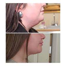 There response time is really fast. Illume Aesthetics 33 Photos 16 Reviews Waxing 993 Siskiyou Blvd Ashland Or Phone Number Yelp