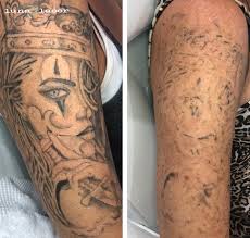 The american society for aesthetic plastic surgery estimates the average cost per session at $463. Laser Tattoo Removal Process Cost Price Luna Laser Brisbane