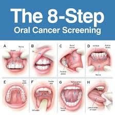 Dental Dental Hygiene School Dental Anatomy Oral Cancer
