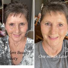 This is my dear, amazingly beautiful friend Julie. This is her results  after 2 months of using our skin care products. You can see the redness is  disappearing, her age spots have