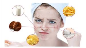 Makanan yang menyebabkan jerawat yang berikutnya adalah whey protein. Ini Makanan Penyebab Jerawat Yang Harus Dihindari Guys Asahansatu