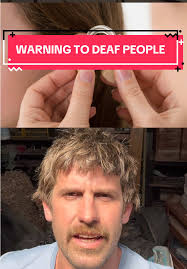 Experiences in the Burns Ward: A Cautionary Tale