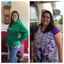 Maybe you would like to learn more about one of these? Bariatric Surgery In Birmingham Al Weight Loss Surgery