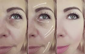 Facelift in Jacksonville. You deserve to Look Your Best!