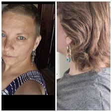 Hair Clippers and Shavers for Bald or Thinning Hair