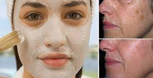 L'aceto di mele contiene solo 3 calorie per cucchiaio, che è un indice molto basso. La Maschera Di Bicarbonato E Aceto Che Elimina Macchie Rughe E Acne Per Sempre Rimedio Naturale