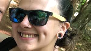 Fundraiser by Samantha Suslik : Donate to help fix my smile