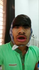 Sumit Patel (@sumitmendapara)