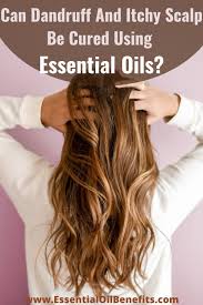 Can Dandruff And Itchy Scalp Be Cured Using Essential Oils In 2020 All Natural Hair Dye Dandruff Natural Haircare