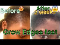 Grow Your Edges Fast In Just 2 Weeks Youtube Edges Hair Grow Edges Hair Growth Faster