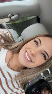 What's your home remedy for bruises from a fall?