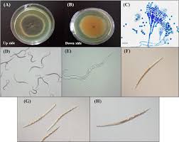Carry shaker или выжимаем дамаг. In Vitro Evaluation Of Penicillium Chrysogenum Snef1216 Against Meloidogyne Incognita Root Knot Nematode Scientific Reports