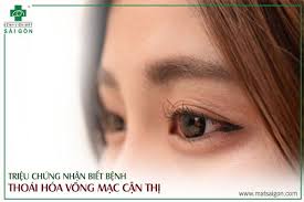 Thoái hóa võng mạc do cận thị, nên điều trị thế nào?