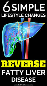 6 Simple Lifestyle Changes That Can Reverse Fatty Liver Disease In 2021 Liver Disease Liver Disease Diet Fatty Liver Disease Diet