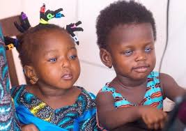 Both genes for blue eyes and red. 5 Rare Eye Colours Of Africans You Would Love To See Face2face Africa