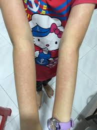 Cara menghilangkan mata panda yang bisa anda coba ternyata beragam. Petua Hilangkan Gegata Cerita Budak Sepet