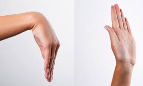 Image result for Scaphoid Fracture Signs