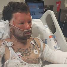 Fundraiser for Ashley Gravley by Cassandra Phillips : Support Corey  Goodman's Road to Recovery