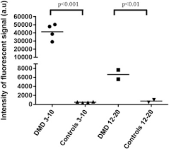 High Urinary Ferritin Reflects Myoglobin Iron Evacuation In Dmd Patients Neuromuscular Disorders Selengkapnya untuk erek erek bergambar. high urinary ferritin reflects