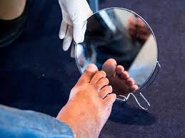 القدم السكري إهمالها يؤدي للبتر ملحق الصحة و الطب ملاحق الخليج