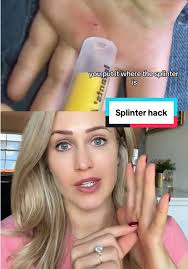 Line Ceramic Splinter