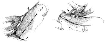 Check spelling or type a new query. Clinical Anatomy Of The Vulva Vagina Lower Pelvis And Perineum Glowm