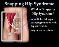 أجد فرقعة في مفصل الورك فما سببها