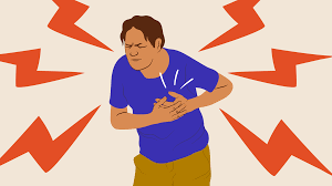 O enfarte agudo do miocárdio, vulgarmente conhecido como ataque cardíaco, ocorre quando uma das artérias do coração fica obstruída por um coágulo, o que se apresentar algum dos sintomas de enfarte agudo do miocárdio deve contactar de imediato o 112 ou pedir ajuda a alguém para o fazer. Infarto Dor No Peito Nao E Unico Sinal Veja Sintomas E Causas Da Doenca 23 10 2018 Uol Vivabem